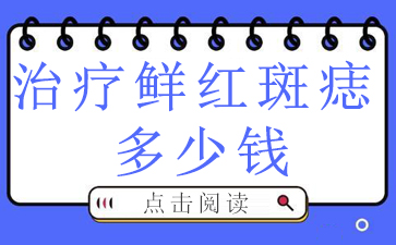 ʺƷ-ʺǮ