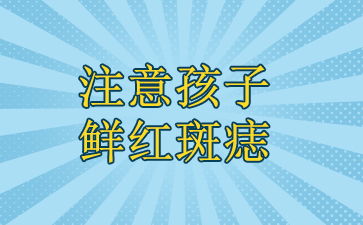 ʺǮ-ע⺢ʺ