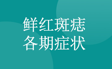 ʺƷ-ʺ֢״